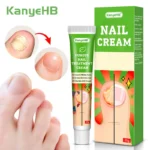 1pcs Fungal Nail Treatment Cream Hand Foot Toe Repair Herb Ointment Nail Fungus Removal Anti Infection Paronychia Nail Care 발톱무좀